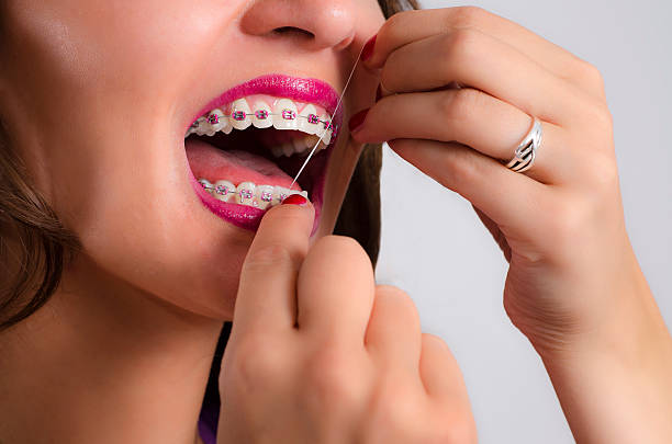 istock Young woman with braces flossing teeth 591429664