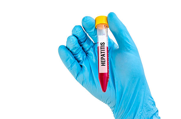 istock Test-tube with blood sample for HEPATITIS 592407036