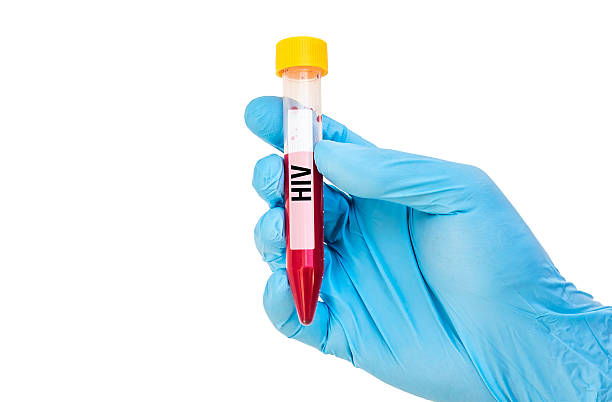 istock Test-tube with blood sample for HIV 592407090