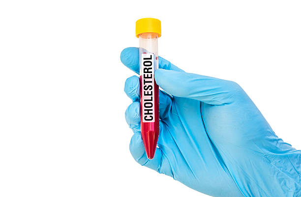 istock Test-tube with blood sample for CHOLESTEROL 592407140