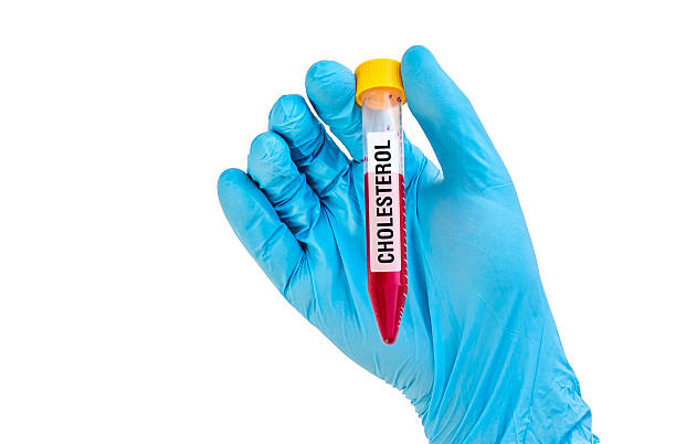 istock Test-tube with blood sample for CHOLESTEROL 592407158