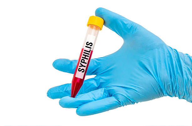 istock Test-tube with blood sample for SYPHILIS 592407340