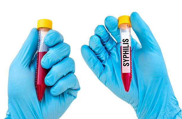 istock Test-tube with blood sample for SYPHILIS 592407348