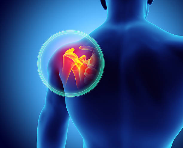 istock Shoulder painful skeleton x-ray, 3D illustration. 592653008