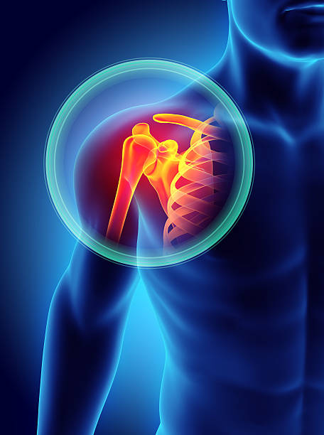 Shoulder painful skeleton x-ray, 3D illustration. 3D illustration, shoulder painful skeleton x-ray, medical concept. 3d human muscle stock pictures, royalty-free photos & images