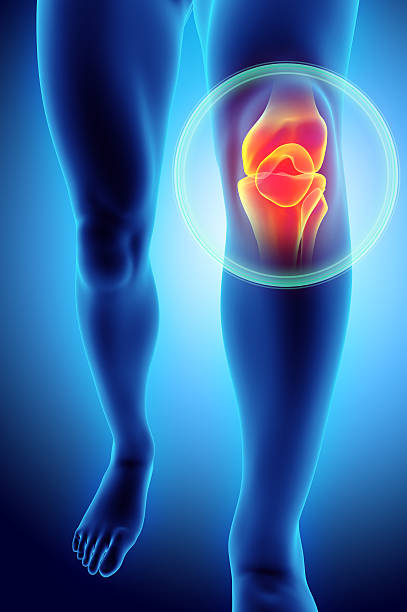 ginocchio doloroso - radiografia scheletro. - pain human knee arthritis human joint foto e immagini stock