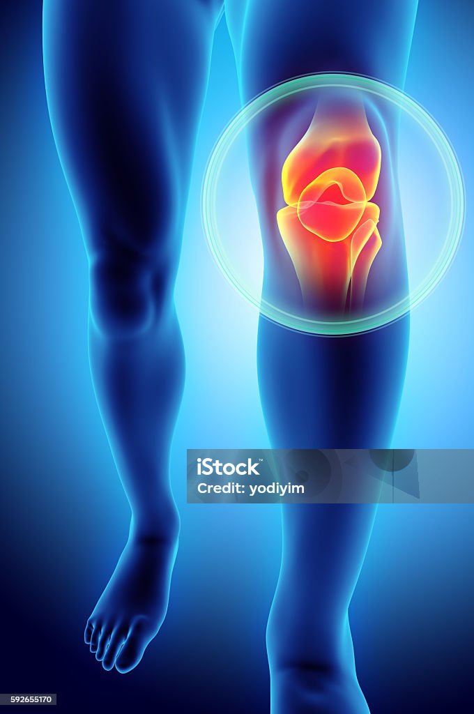 Knee painful - skeleton x-ray. Knee painful - skeleton x-ray, 3D Illustration medical concept. Pain Stock Photo