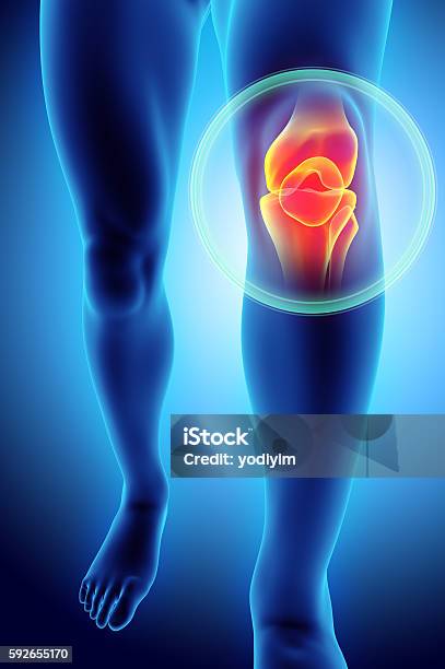 Knee Painful Skeleton Xray Stock Photo - Download Image Now - Pain, Joint - Body Part, Arthritis