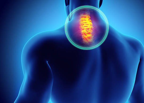 3D illustration, neck painful - cervica spine skeleton x-ray, medical concept.
