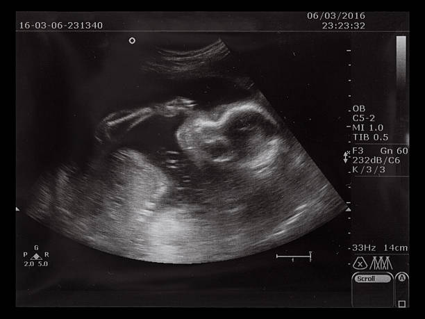 istock Ultrasonography picture 593325862