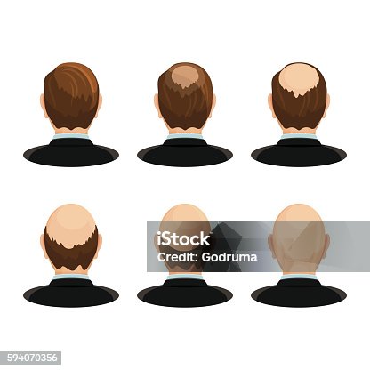 64 Back Of Bald Head Illustrations & Clip Art - iStock | Back of head, Bald  woman, Question mark