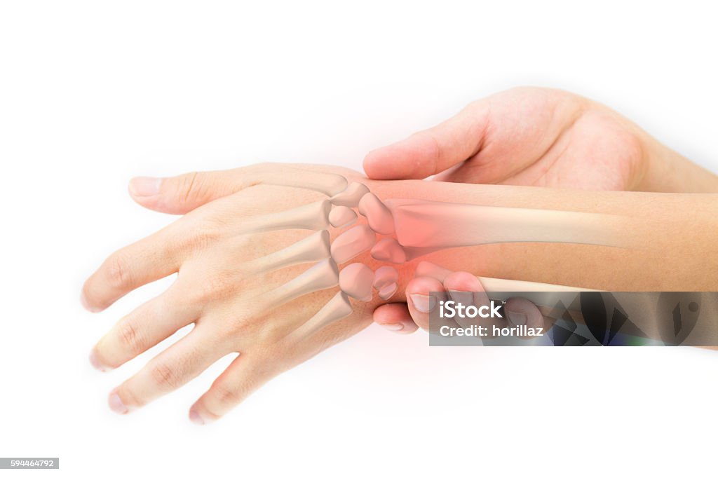 wrist bones injury Acute Angle Stock Photo