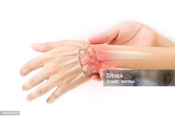 Wrist Bones Injury Stock Photo - Download Image Now - Acute Angle, Alternative Therapy, Anger