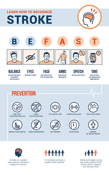 Stroke emergency Stroke emergency awareness, recognition signs, preventions and informations, medical procedure infographic stroke illness stock illustrations