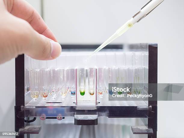 Cuvette Lab Inversion Lab With A Pipette In A Cuvette Segments Medical Lab Stock Photo ...