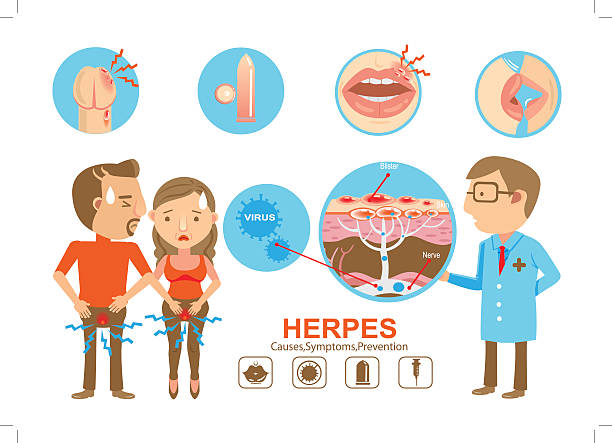 Herpes Doctor holding diagram Herpes on the lips and genitals of the young woman And young men. Cartoon vector illustration And genitals genital herpes stock illustrations