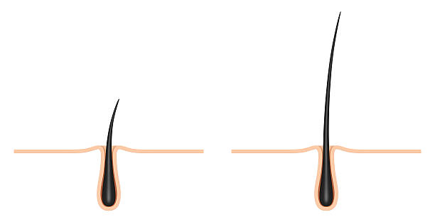 istock hair follicle. cross section. 596371936