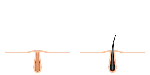 istock hair follicle. the cross section. 596371940