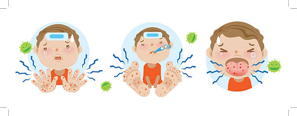 HFMD HFMD children infected. hand foot and mouth disease.Cartoon vector illustration hand foot and mouth disease stock illustrations