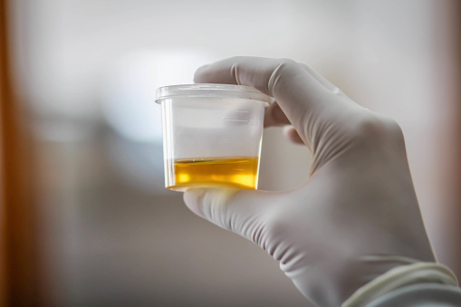 Glycerin in glass beaker and brown amber bottle inside laboratory with copy space.