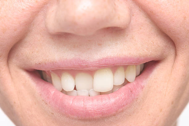 mujer dientes torcidos - sesgado fotografías e imágenes de stock