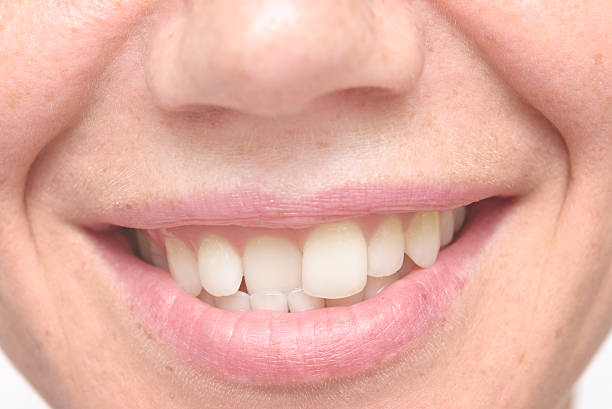 woman crooked teeth - diagonal imagens e fotografias de stock