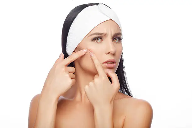 Young woman squeezing her pimple, removing pimple from her face. Woman skin care concept. Acne spot pimple spot skincare beauty care girl pressing on skin problem face.