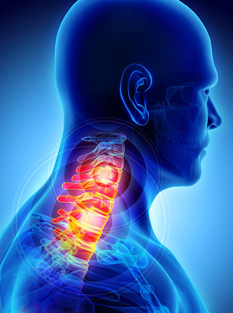 istock Neck painful - cervica spine skeleton x-ray, 3D illustration. 597657728