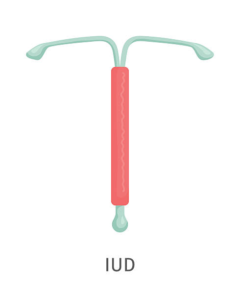 避妊法 - iud.医療子宮内装置。妊娠を計画する。 - iucds点のイラスト素材／クリップアート素材／マンガ素材／アイコン素材