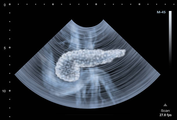 ultraschall-scan der menschlichen bauchspeicheldrüse. abbildung - kamera film grafiken stock-fotos und bilder