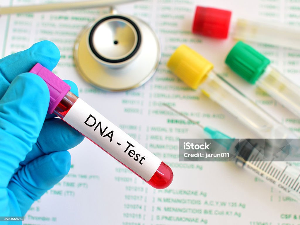 DNA testing Blood sample for DNA testing Biotechnology Stock Photo