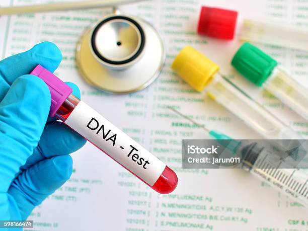Dna Testing Stock Photo - Download Image Now - Biotechnology, Blood, Chromosome
