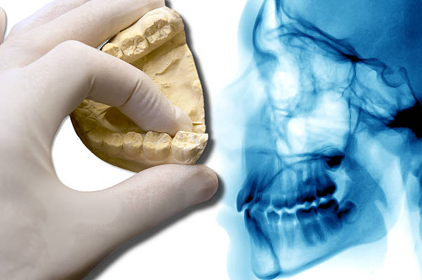 istock dental care molar tooth over cephalometric 598214550