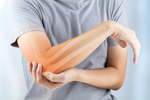 elbow bones injury elbow bones injury white background rheumatoid arthritis stock pictures, royalty-free photos & images