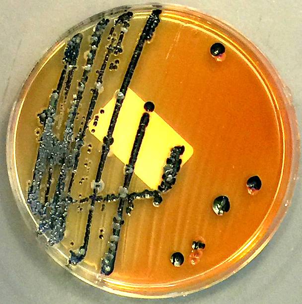 salmonellen gemischt mit anderen enterobakterien - serotype stock-fotos und bilder