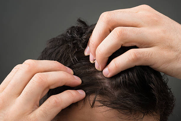 Cropped Image Of Man Suffering From Hair Loss Cropped image of man suffering from hair loss against gray background hair treatment stock pictures, royalty-free photos & images