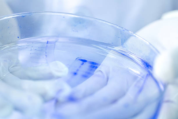 protein run on SDS-PAGE gel