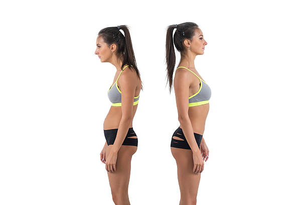 Woman with impaired posture position defect scoliosis and ideal bearing Woman with impaired posture position defect scoliosis and ideal bearing. bad posture stock pictures, royalty-free photos & images