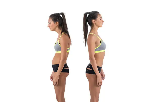 Photo of Woman with impaired posture position defect scoliosis and ideal bearing