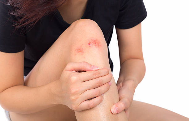 istock Woman with knee feeling pain on white background 599678514