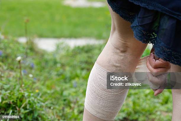 Woman With Varicose Veins Applying Compression Bandage Stock Photo - Download Image Now