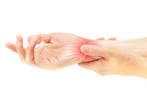wrist bones injury - handwortelbeen fotos stockfoto's en -beelden