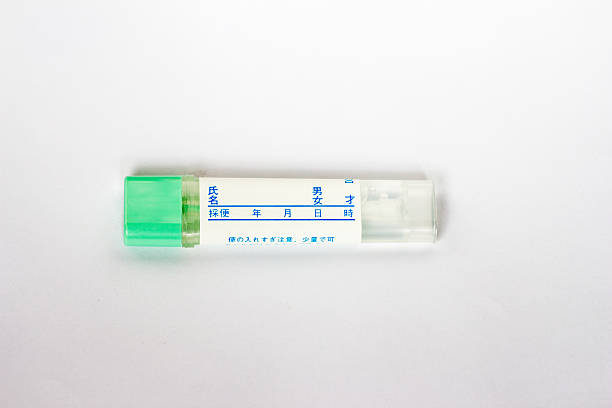 istock Container of feces examination 599976720