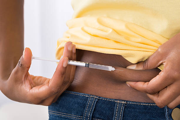 胃を注入する糖尿病女性 - surgical needle 写真 ストックフォトと画像