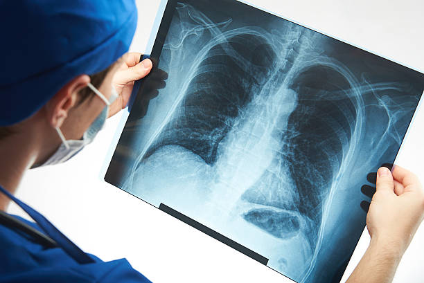 istock x-ray image of human chest 601020096