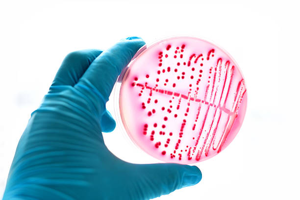 bakterien kolonien - blood agar stock-fotos und bilder