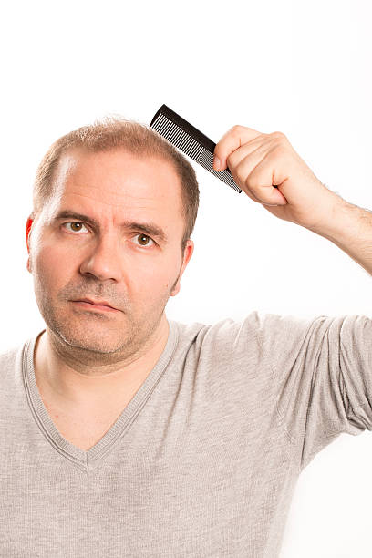 istock Senior man and hair loss issue 601915680