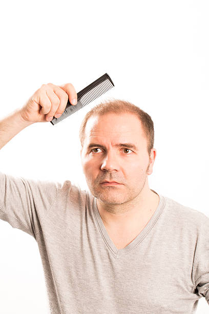 istock Senior man and hair loss issue 601916768