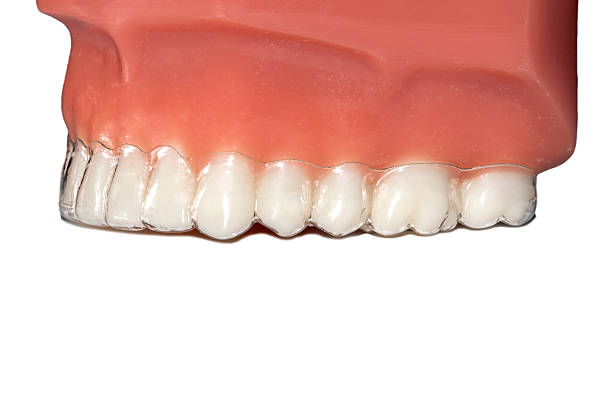 istock invisible orthodontic removable aligners teeth jaw 603278978