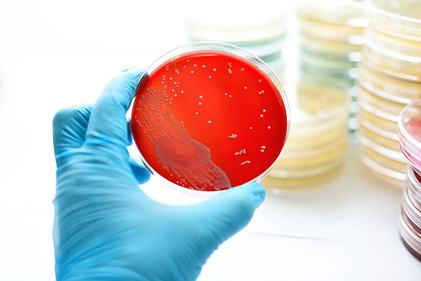 bakterien kultur - blood agar stock-fotos und bilder